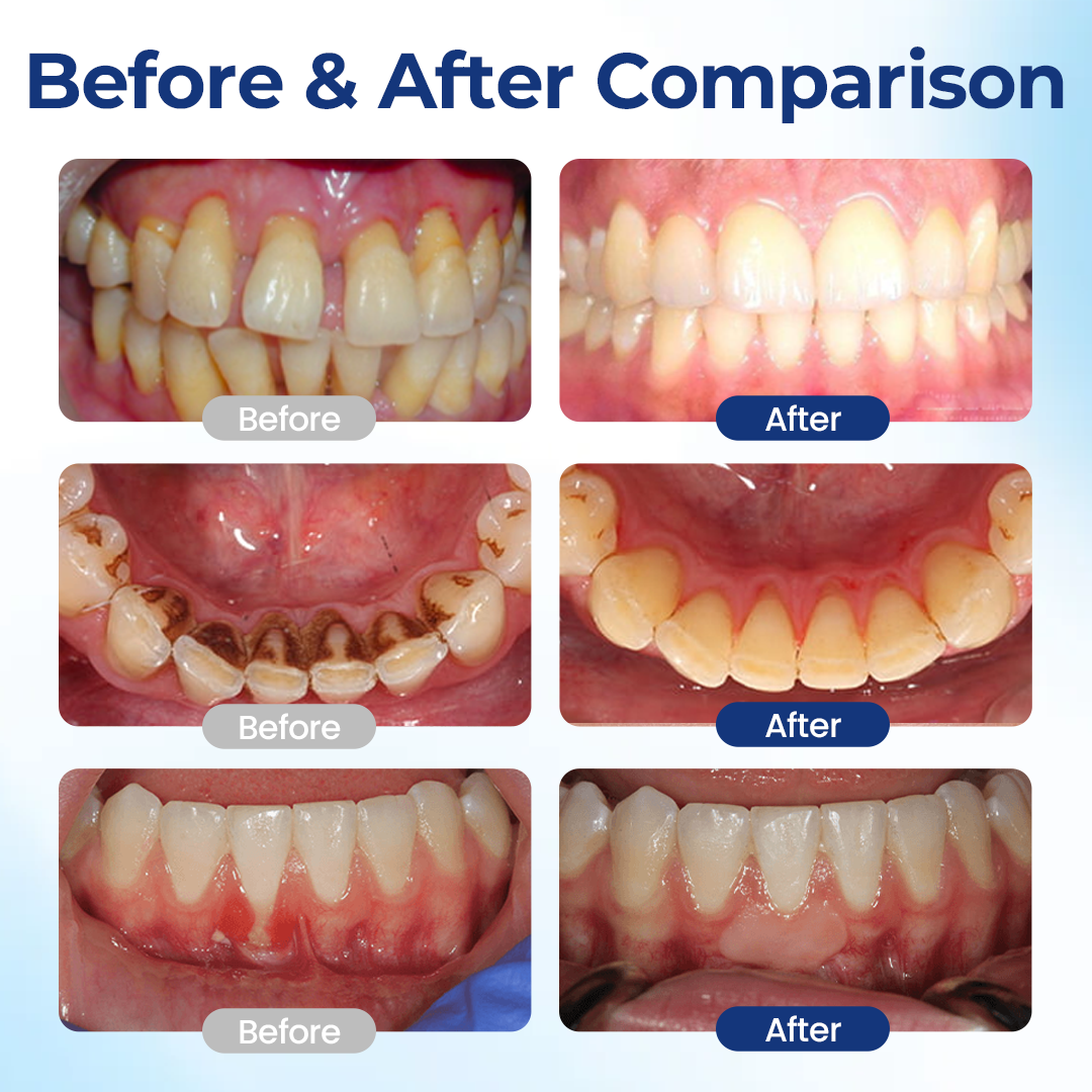 💝Bloeamly Bee Repair Complex Oral Repair Solution