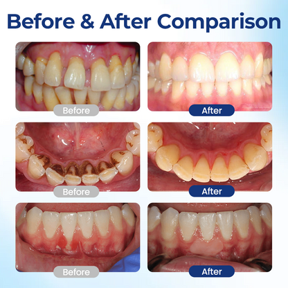 💝Bloeamly Bee Repair Complex Oral Repair Solution